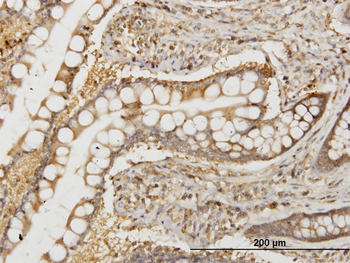 NMI monoclonal antibody (M04), clone 9E8