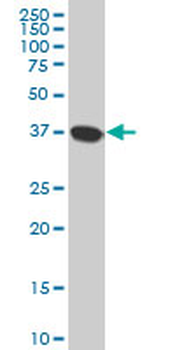 NMI monoclonal antibody (M04), clone 9E8