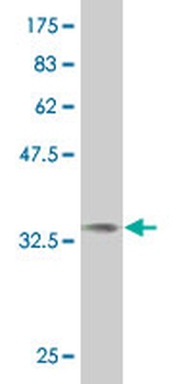 NMI monoclonal antibody (M04), clone 9E8
