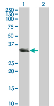 UNC119 monoclonal antibody (M01), clone 2F9-2A9