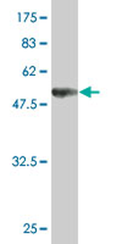 UNC119 monoclonal antibody (M01), clone 2F9-2A9