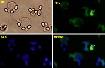 CLDN1 monoclonal antibody (M02), clone 2E2-H5