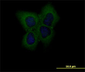 CLDN1 monoclonal antibody (M02), clone 2E2-H5