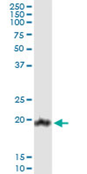 CLDN1 monoclonal antibody (M02), clone 2E2-H5