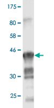 CLDN1 monoclonal antibody (M02), clone 2E2-H5