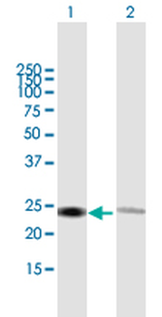 RPL14 purified MaxPab mouse polyclonal antibody (B01P)