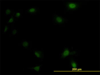 UBE2M monoclonal antibody (M01), clone 3C4