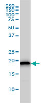 UBE2M monoclonal antibody (M01), clone 3C4