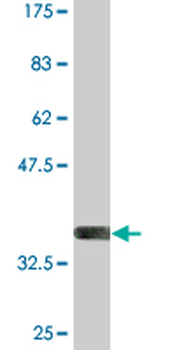 PKD2L1 monoclonal antibody (M01), clone 4F9