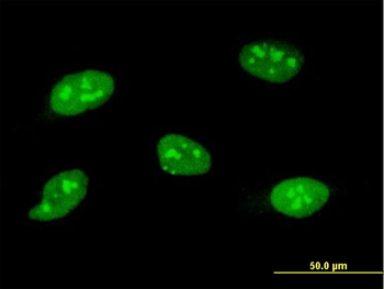 SOCS3 monoclonal antibody (M02), clone 1E4