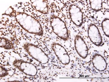 SOCS3 monoclonal antibody (M02), clone 1E4