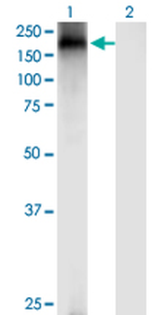 TRPA1 monoclonal antibody (M03), clone 6G8