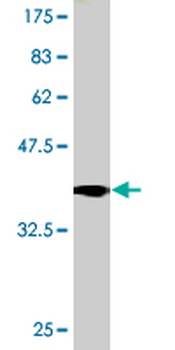 TRPA1 monoclonal antibody (M03), clone 6G8