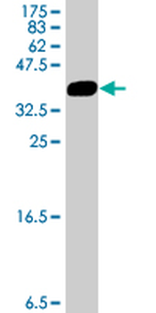 AP1M1 polyclonal antibody (A01)