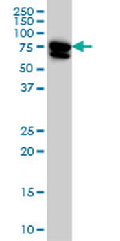 MTMR2 monoclonal antibody (M03), clone 4G6