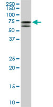 MTMR2 monoclonal antibody (M03), clone 4G6