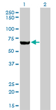 MTMR2 monoclonal antibody (M03), clone 4G6
