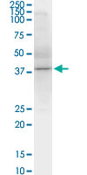 SPHK1 monoclonal antibody (M01), clone 1D6