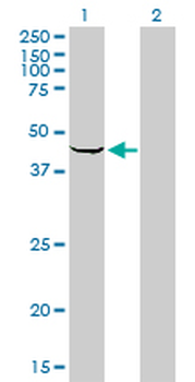 SPHK1 monoclonal antibody (M01), clone 1D6