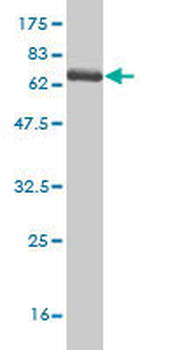 SPHK1 monoclonal antibody (M01), clone 1D6