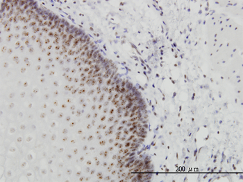 PER2 monoclonal antibody (M01), clone 5C10