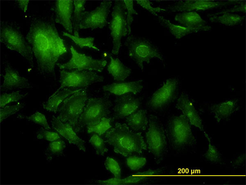 TSC22D1 monoclonal antibody (M01), clone 1G7
