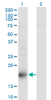 TSC22D1 monoclonal antibody (M01), clone 1G7