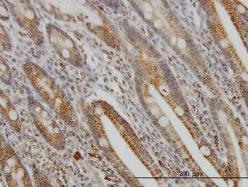 GMPS monoclonal antibody (M01), clone 1D10