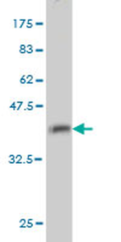 GMPS monoclonal antibody (M01), clone 1D10