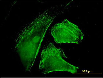 IQGAP1 monoclonal antibody (M01), clone 2C5