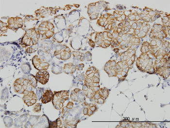 IQGAP1 monoclonal antibody (M01), clone 2C5