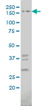 IQGAP1 monoclonal antibody (M01), clone 2C5
