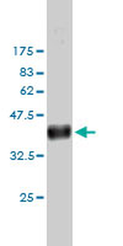 IQGAP1 monoclonal antibody (M01), clone 2C5