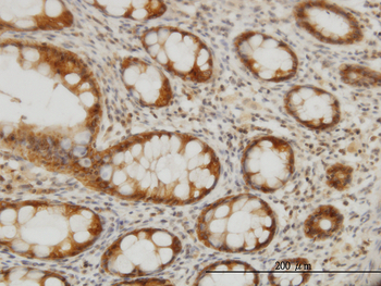 CES2 monoclonal antibody (M02), clone 4F12