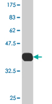 CES2 monoclonal antibody (M02), clone 4F12