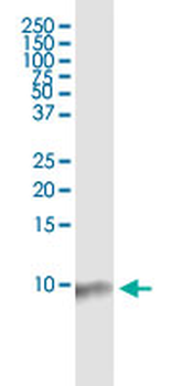 BANF1 monoclonal antibody (M07), clone M2