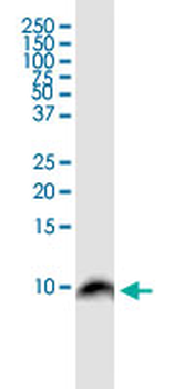 BANF1 monoclonal antibody (M07), clone M2