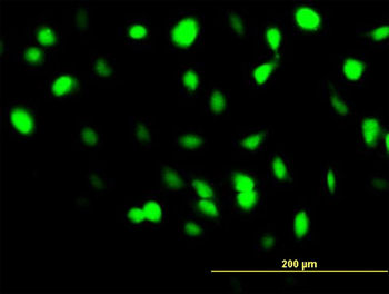 BANF1 monoclonal antibody (M07), clone M2