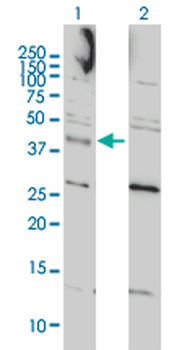 CCNK monoclonal antibody (M01), clone 3B7-1B9