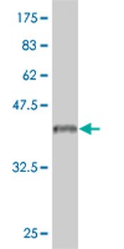 IL18RAP monoclonal antibody (M04), clone 4G4