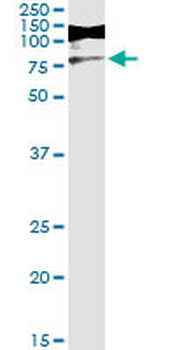 RIOK3 monoclonal antibody (M01), clone 4A12-1D2