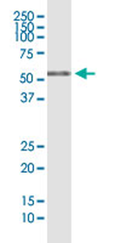 RIOK3 monoclonal antibody (M01), clone 4A12-1D2