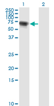 RIOK3 monoclonal antibody (M01), clone 4A12-1D2