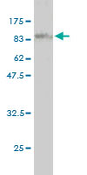 RIOK3 monoclonal antibody (M01), clone 4A12-1D2