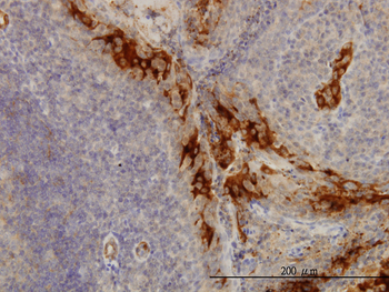 TNFRSF6B monoclonal antibody (M02), clone 7G5