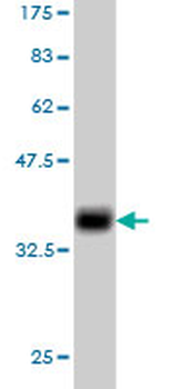 TNFRSF6B monoclonal antibody (M02), clone 7G5