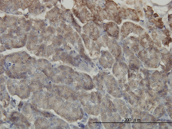 RIPK2 monoclonal antibody (M05), clone 7F5