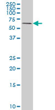 RIPK2 monoclonal antibody (M05), clone 7F5