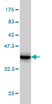 RIPK2 monoclonal antibody (M05), clone 7F5