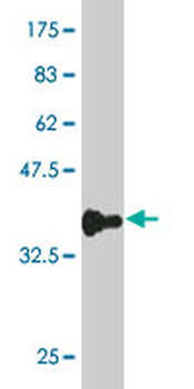 CDS2 monoclonal antibody (M01), clone 2B9